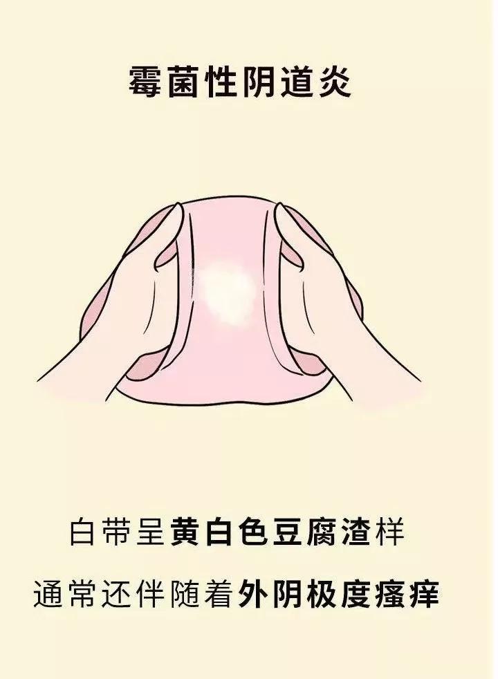 姑娘们注意啦!没有*生活性**也可能会得这种病