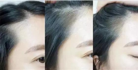 睫毛增长液真的有用吗测评,吉克隽逸睫毛增长液同款