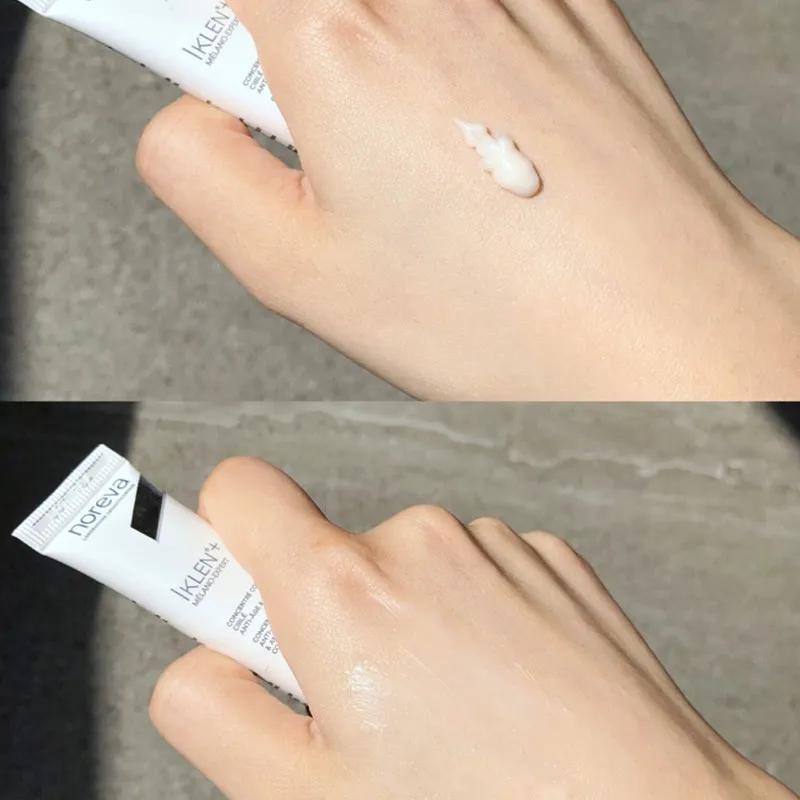 十年战痘肌自救指南,十年痘肌怎么抗痘