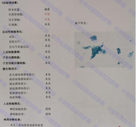 tct炎症反应性细胞改变需要治疗吗,tct显示中度炎症妇科怎么治疗