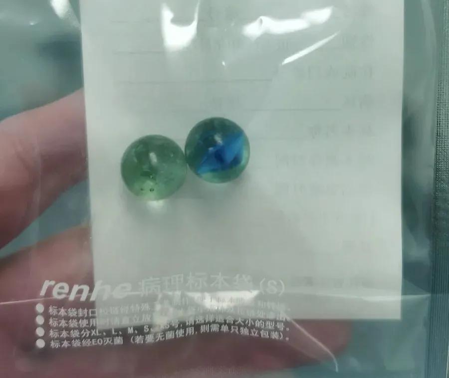 四岁小男孩往小丁丁里塞弹珠?那些年孩子塞进去的东西远不止这个