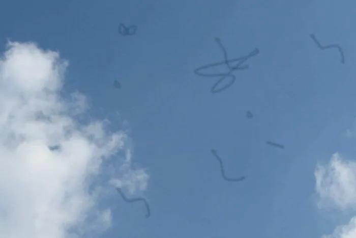 为什么眼睛里有黑点跑来跑去,眼睛前面总有黑点在飘是什么原因