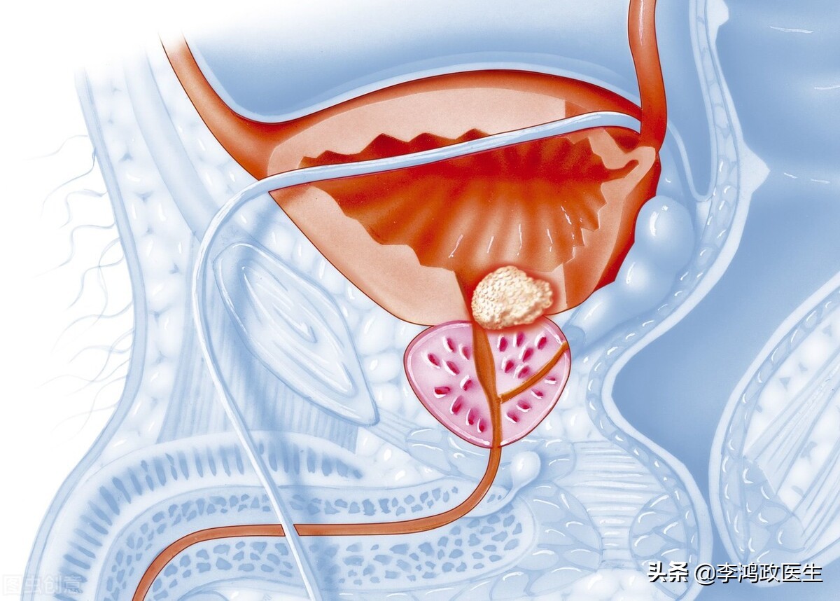 男子胸闷具体怎么了,男子胸闷