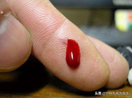 三个症状说明你已经感染艾滋病,有安全措施感染艾滋几率