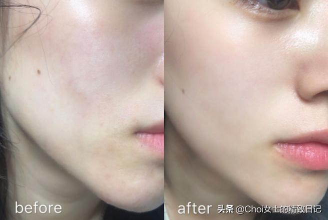 冻干粉,干粉适合冬天用吗