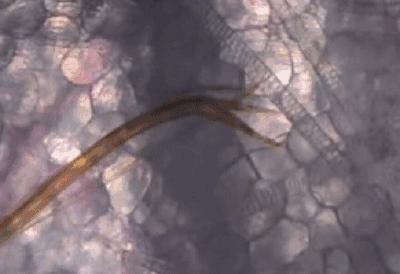 艾滋病是否通过蚊子传染,蚊子拍出血会传染艾滋病吗