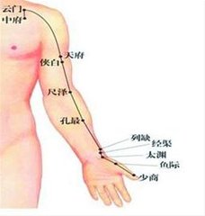 摆脱半身不遂，针灸来帮忙