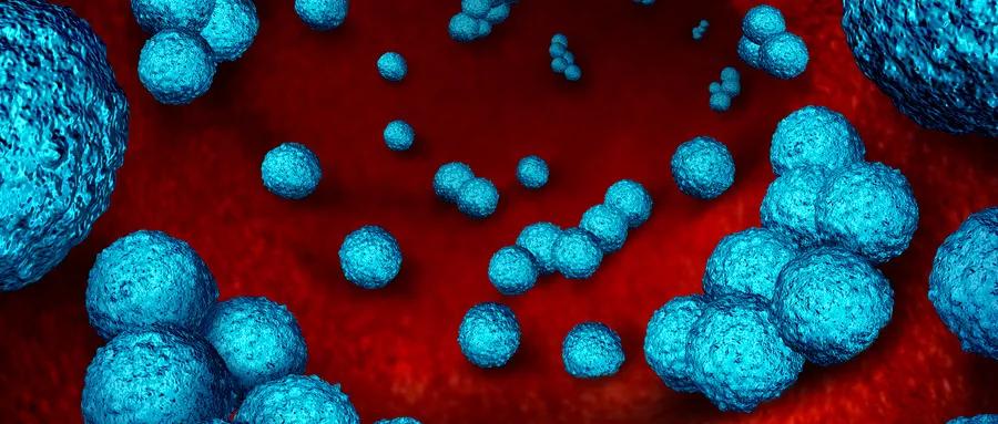 不想肿瘤结节发展注意3点,不想癌细胞扩散的建议