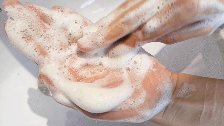 控油好不伤头皮的好洗发水,为什么有的洗发水用了头皮特别多