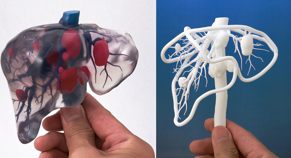 为什么说不锈钢可以植入人体,造福人类发明了什么