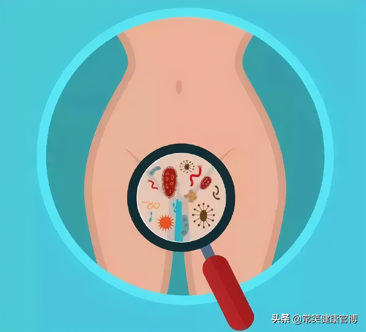 超40%妇女都得过宫颈炎！除白带增多以外还有哪些症状？