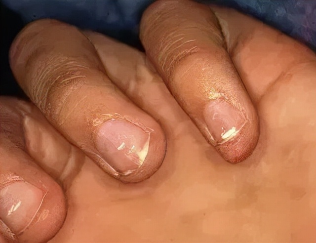 美甲的指甲怎么养护才好看,如何不做美甲就能让指甲变得精致