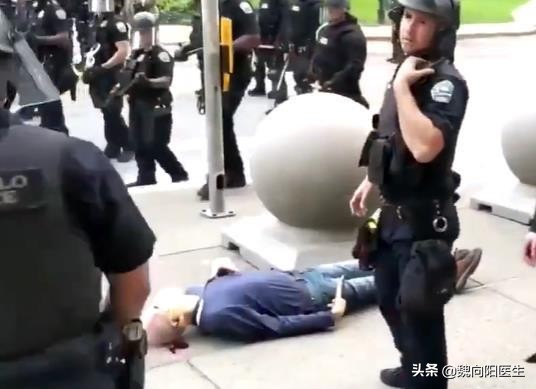 为什么后脑勺怕风,后脑勺着地好不好