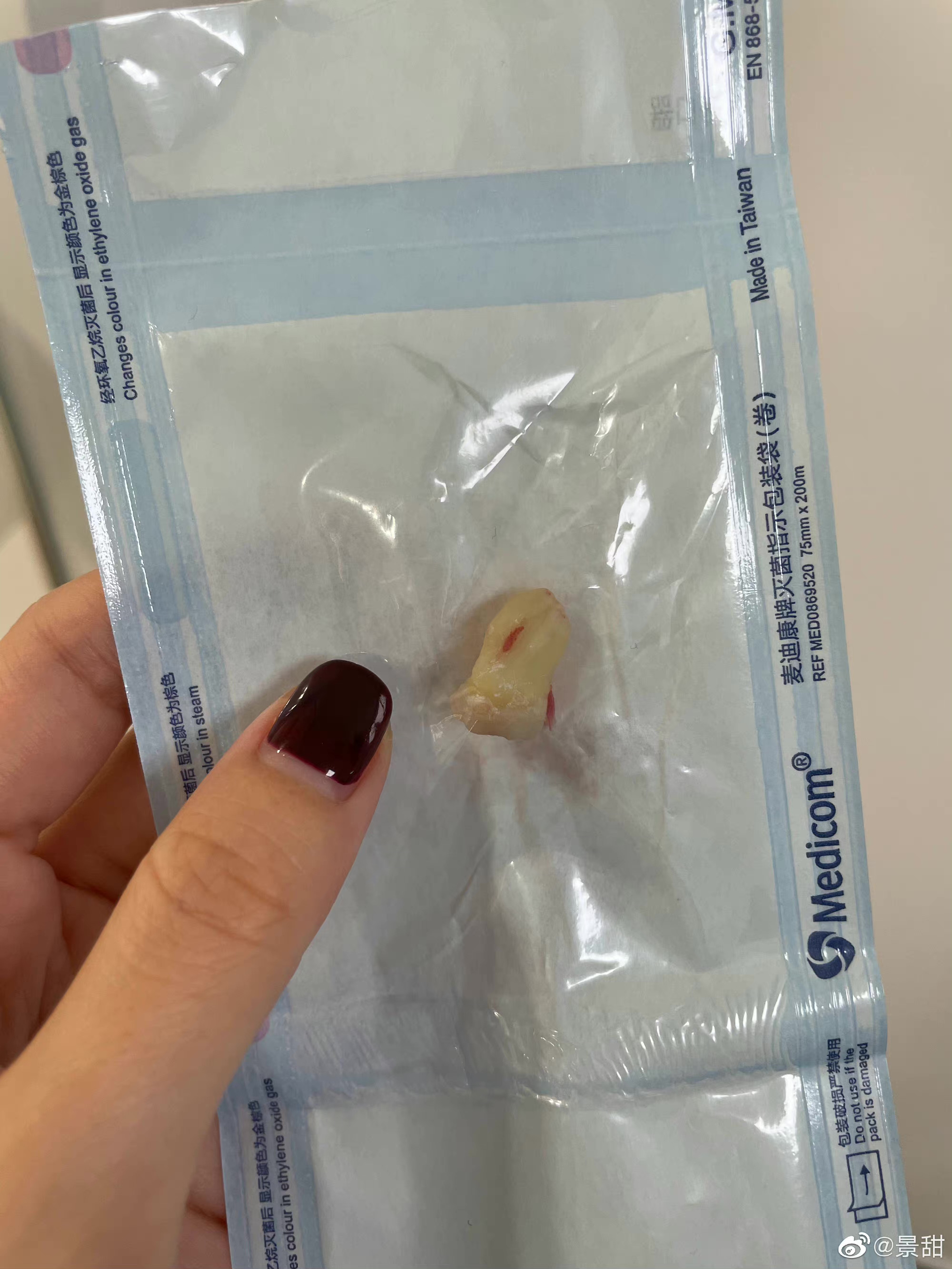 景甜拔牙后自拍照,景甜拔牙后的自拍照