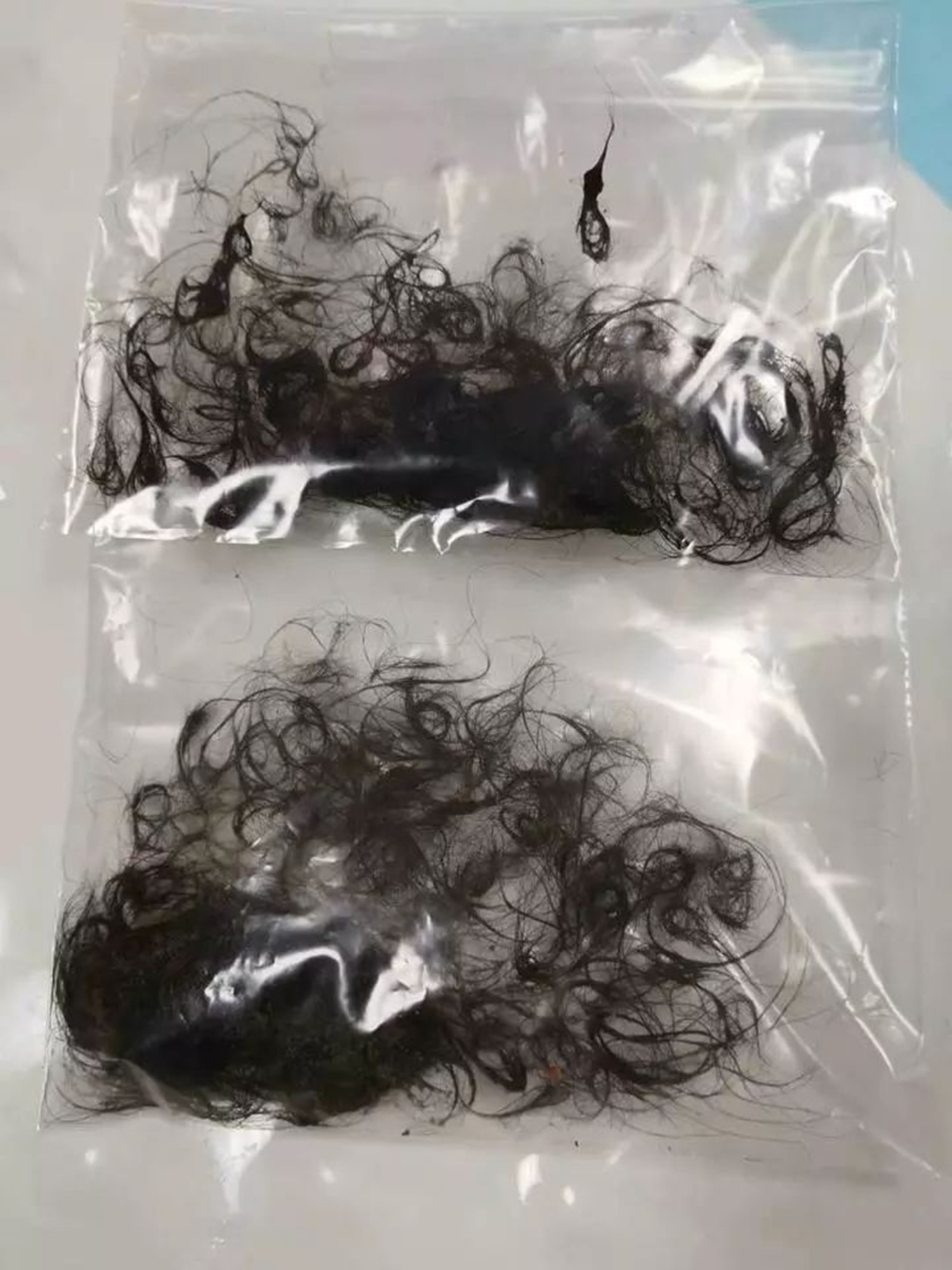 三岁小孩老是喊肚子痛是为什么,三岁多小孩喊肚子疼怎么回事