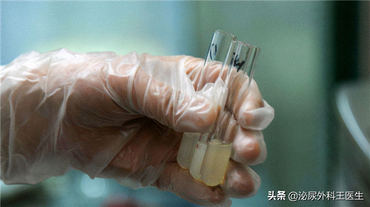 “一滴精等于十滴血”?这5个精液知识,夫妻都应知道