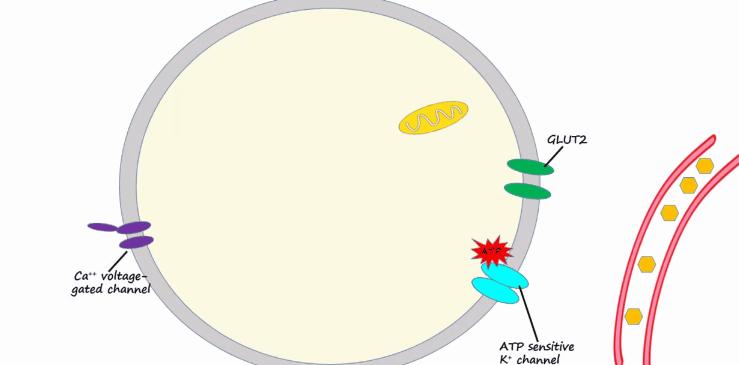 胰岛素是如何导致糖尿病的,胰岛素增多为什么会导致糖尿病