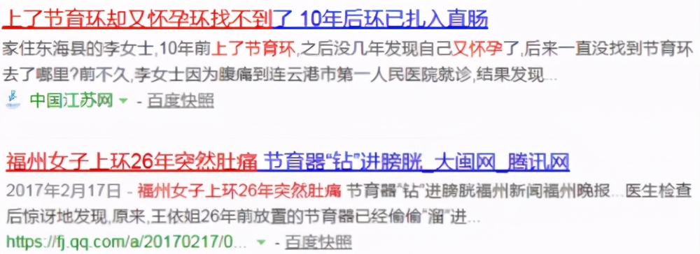 子宫里放节育环,钉在子宫上的节育环会不会掉