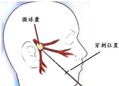 痛痛病疼痛特点,酸痛胀痛或刺痛有什么差别