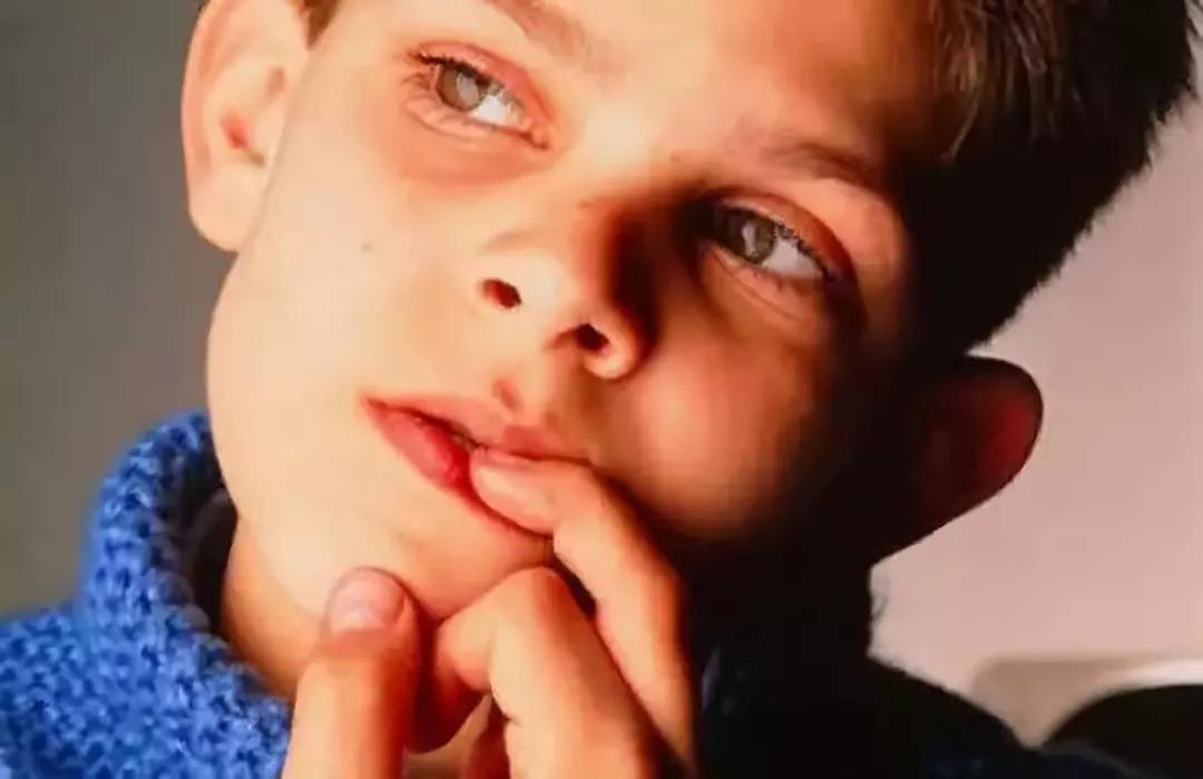 忍不住撕手皮,忍不住想撕手皮怎么回事