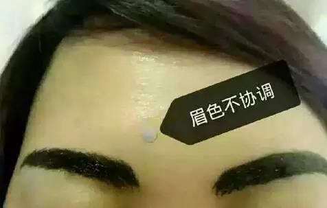 深圳传奇光学科技美容,深圳传奇光学祛斑仪器