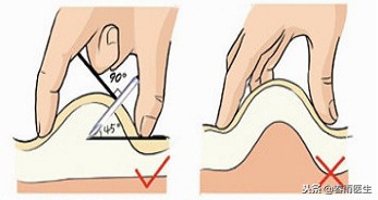 打胰岛素会不会引起大便出血,注射胰岛素凝血功能差皮下出血