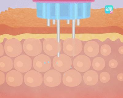 沙漠大干皮敏感肌救星,沙漠干皮救星视频