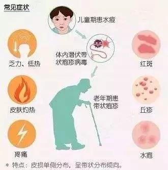 带状疱疹合并二阳咋办,带状疱疹一针疗法