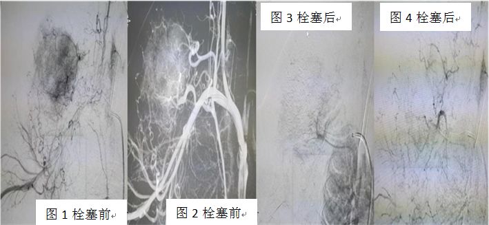 卡梅综合征说明什么,卡梅现象与卡梅综合征