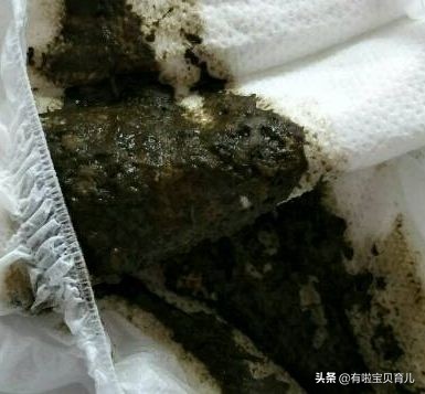 宝宝拉绿便不怎么长肉喝什么奶粉,宝宝拉绿色便便是妈妈吃凉的了吗