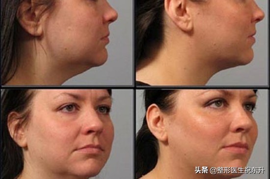 医生不会告诉你的这些知识,医生不会说的