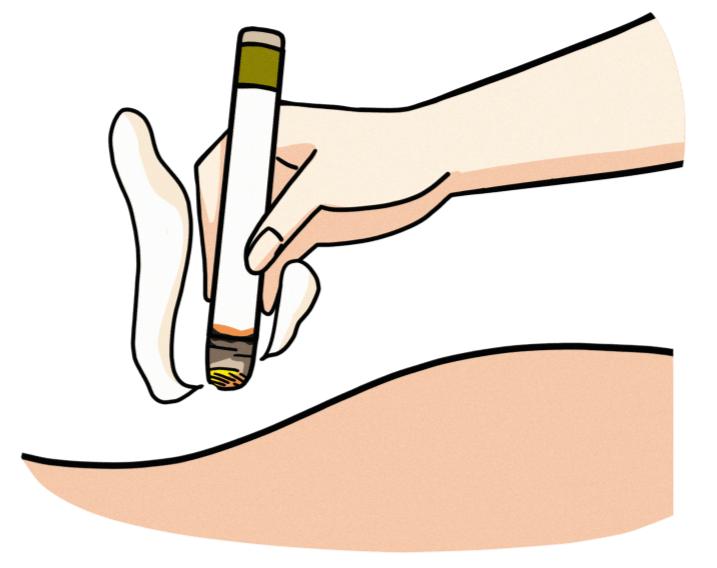 白带异常一招解决,教你怎么看白带异常