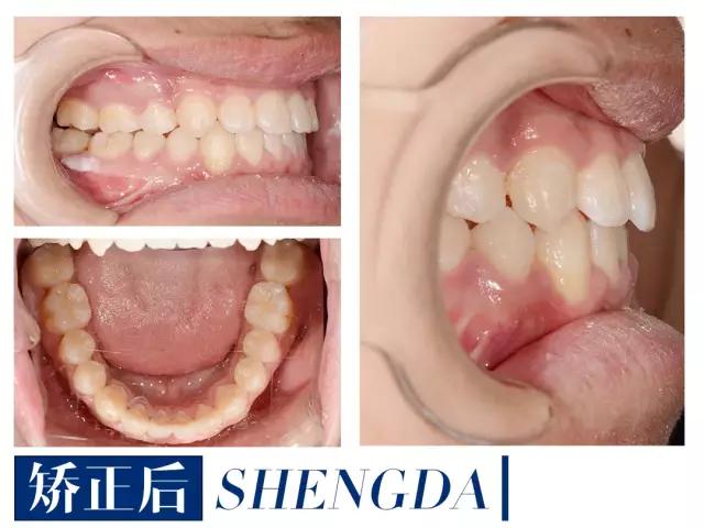 山西“爱马仕”级别齿科医院!get明星同款笑容