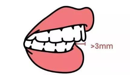 凸嘴微笑练习方法表情管理,前凸嘴怎么做表情管理