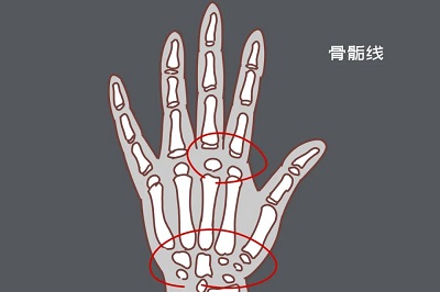 生完孩子长高了真实案例,生完宝宝宝妈个子长高了