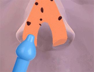 宝宝鼻塞流鼻涕太难受,这个缓解小方法,安全又管用