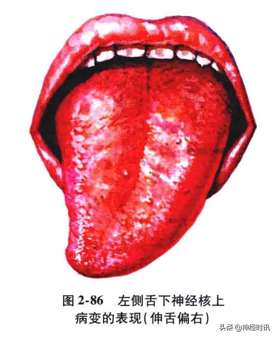 脑干解剖,脑干神经解剖