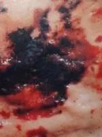 猪瘟和弓形体病的区别在哪里,各种猪病解剖诊断图非瘟