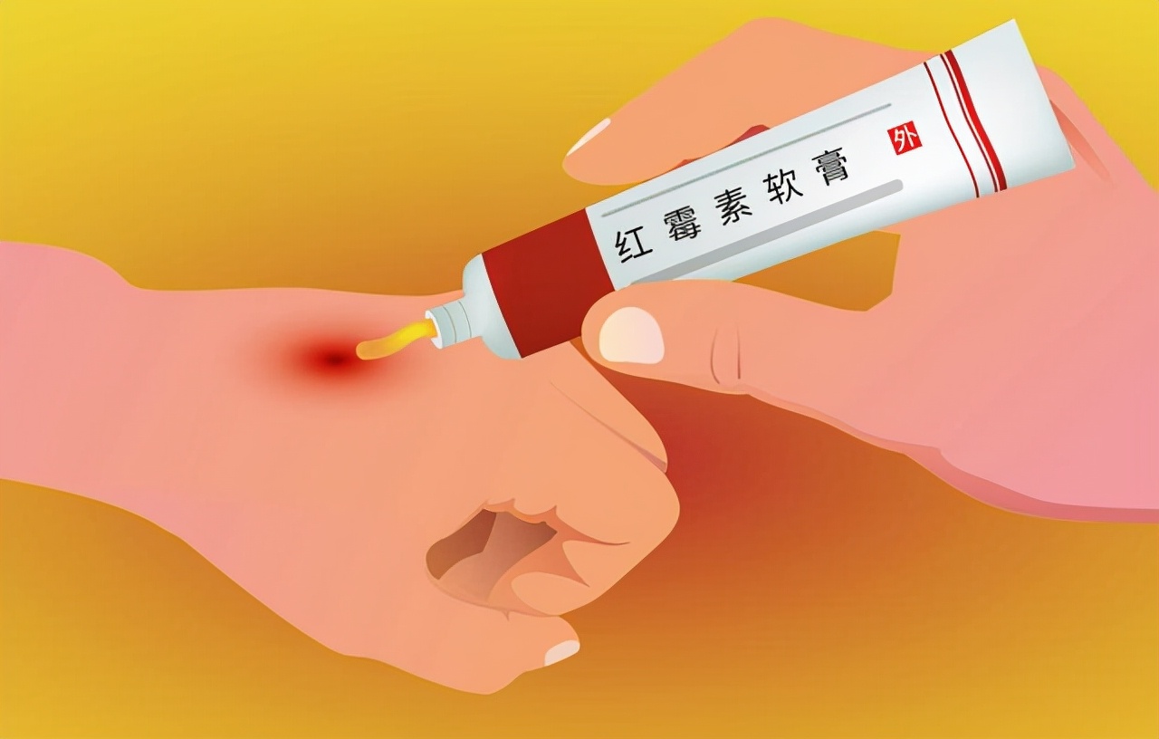 眼部过敏用红霉素软膏可以吗,红霉素软膏用在眼部一次有影响吗