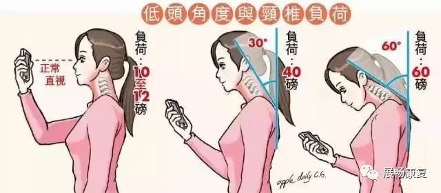 脖子难受怎么办呢,脖子不舒服该怎么办