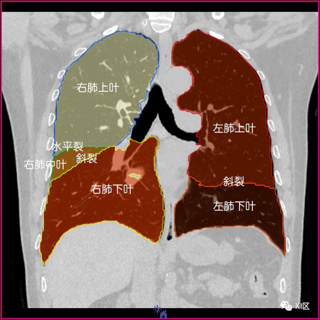 如此详细的肺部影像解剖，有点儿酷