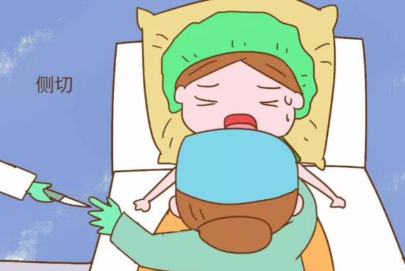 顺产侧切过二胎顺产有影响吗,产妇顺产侧切的多吗