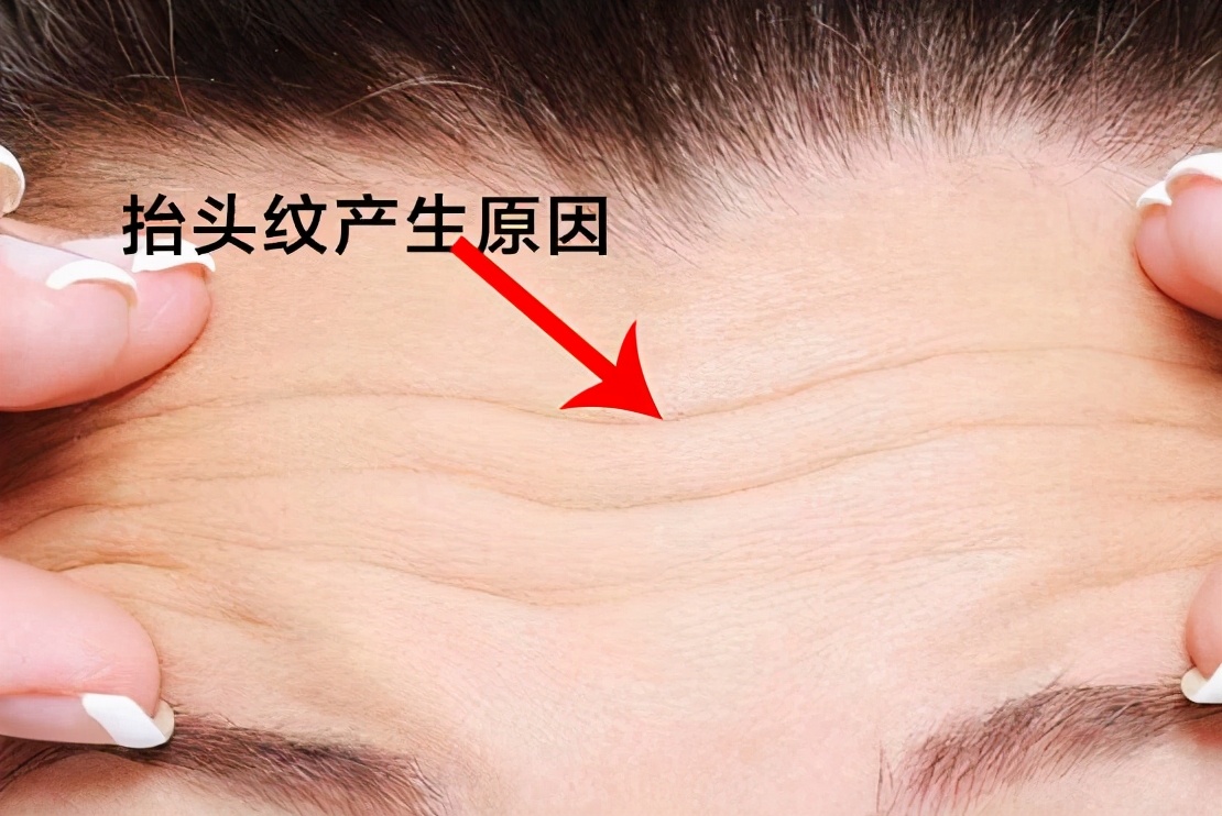为什么抬头纹显得人这么老,多年的抬头纹怎么解决