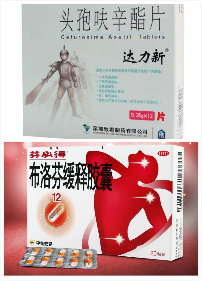 明星强直性脊柱炎患者,强直性脊柱炎明星患者