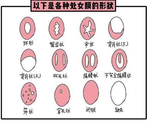 想不到！一个宋朝主张推广的体检项目，到今天还在坑害女人