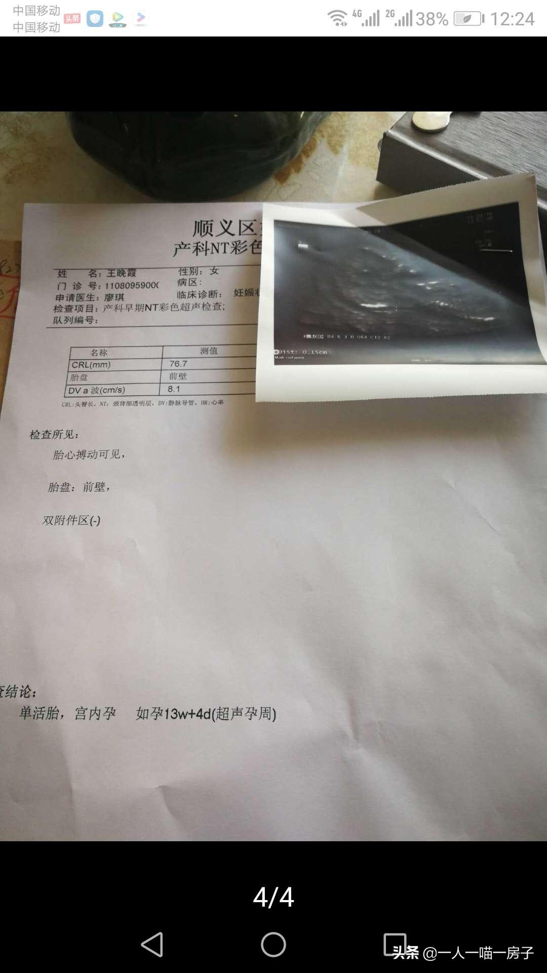 孕期日记：顺利通过无创DNA