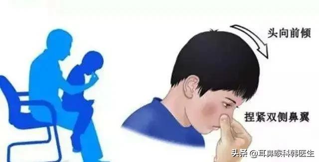 鼻子出血的正确处理法,鼻子出血的正确救治方法是什么