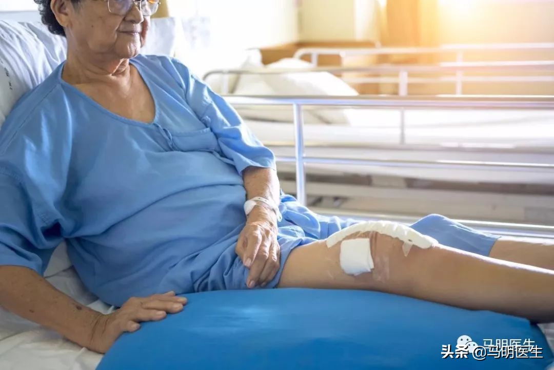 膝关节骨性关节炎治疗指南2018,膝关节骨性关节炎循证医学指南