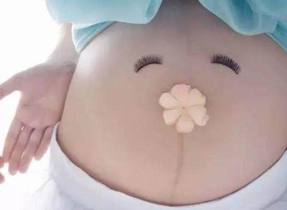 孕妈备皮想让老公代劳,不料护士却这样说,关于备皮你了解多少呢