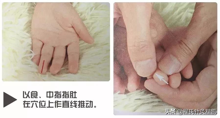 湿疹推拿要清脾还是补脾,小儿湿疹的推拿方法